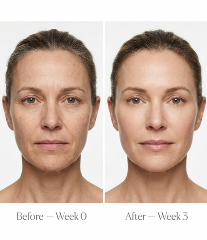 Sculpté™ Skin Renewal Roller